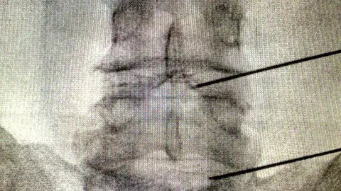 Intervención-1024x872