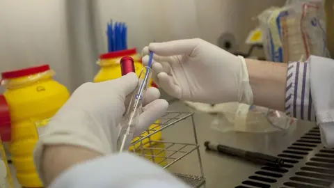 Muestra para el análisis.