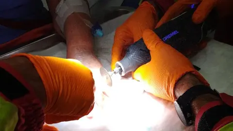 Momento en el que los bomberos cortaron los anillos con la radial